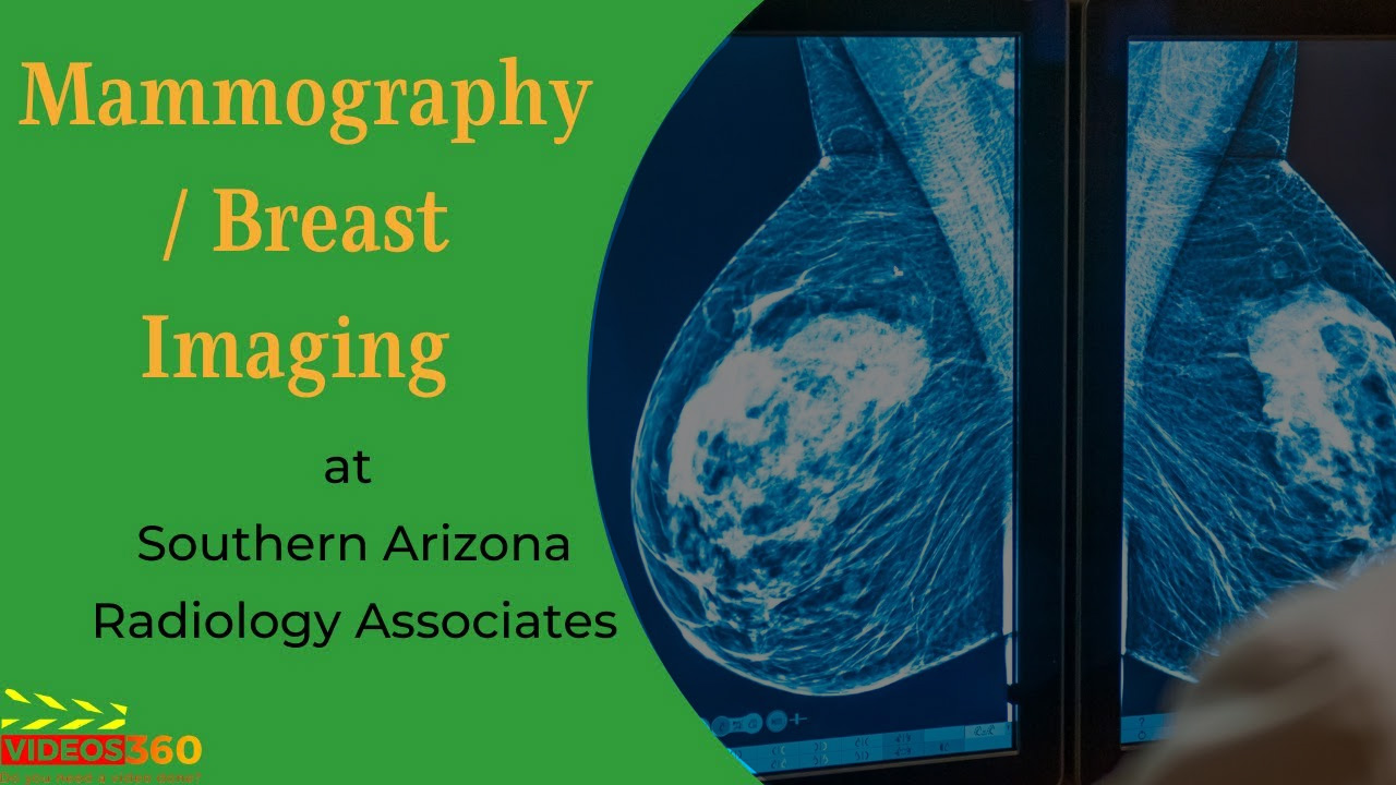 Mammography (Breast Imaging) Tucson, Sierra Vista AZ